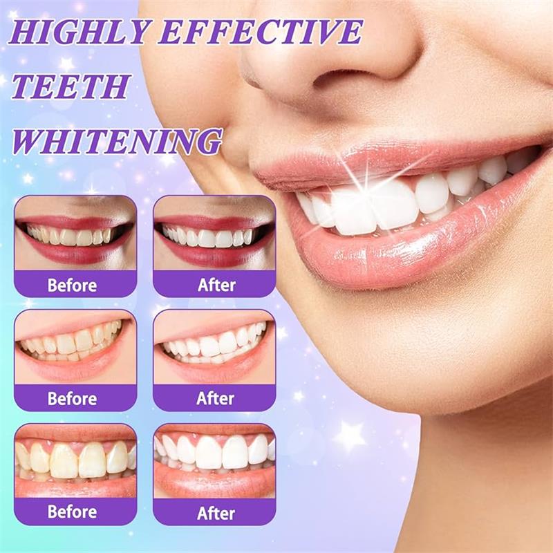 9D Purple Teeth Whitening Toot - огляд і ціна Purple Toning Shampoo
