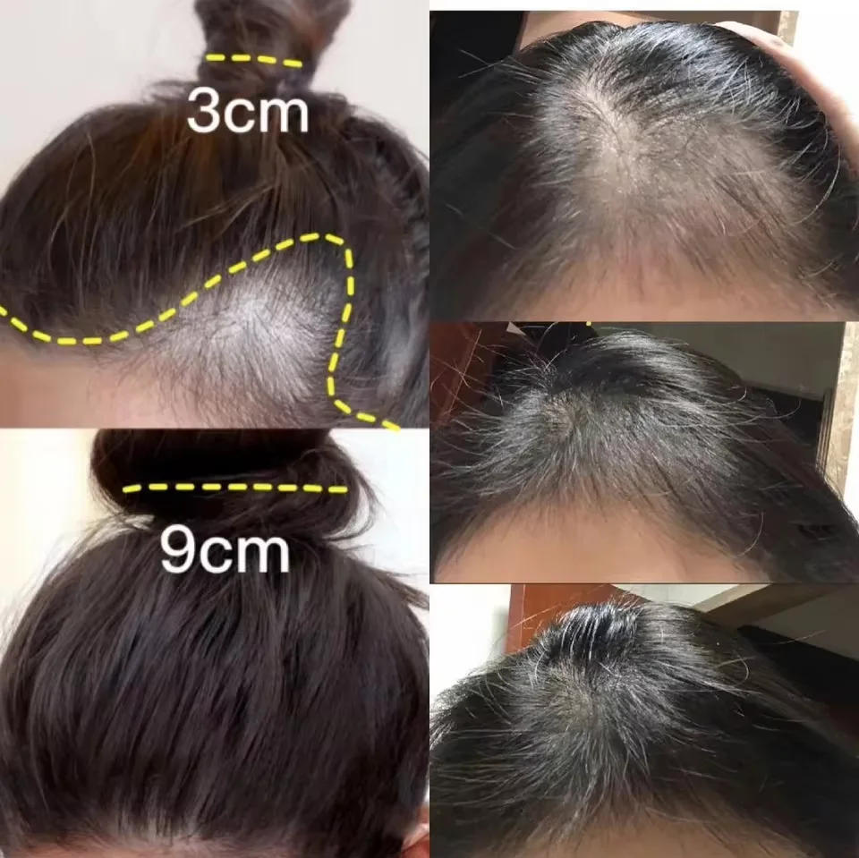 Fast Ginger Hair Growth Cream  - огляд і ціна Hair Care Dupes