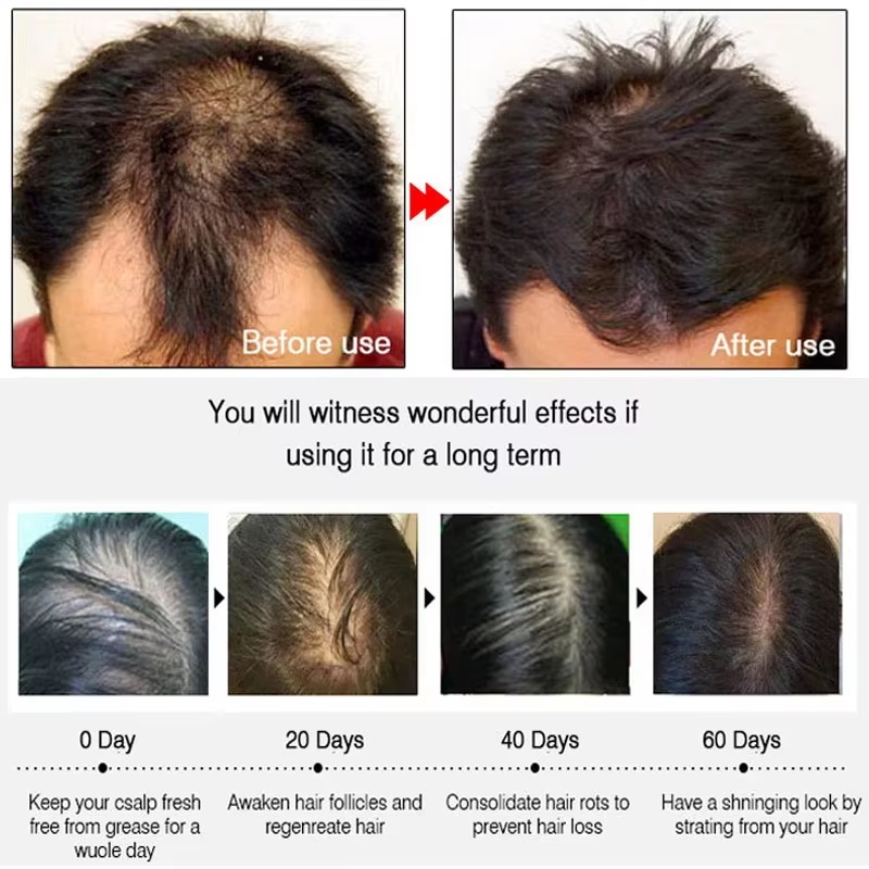 Fast Ginger Hair Growth Spray  - огляд і ціна Hair Care Natural